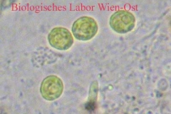 Wasser-Grünalge - Chlorococcum sp.