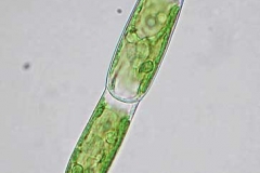 Kappenalge - Oedogonium sp.